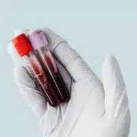 Would organ removal shock your life?