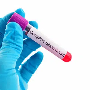 SOP hair and makeup blood test CBC Kit