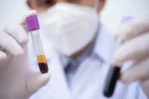 Yearly checkup panels are elevated at 60? Its Normal?