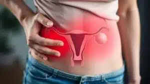 ovarian cancer, ca125 blood test HPV Variant Kit