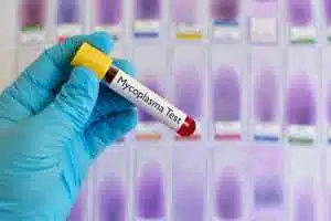 Mycoplasma, STD, STI test herpes and HSV MGen elite London Escorts 24/7